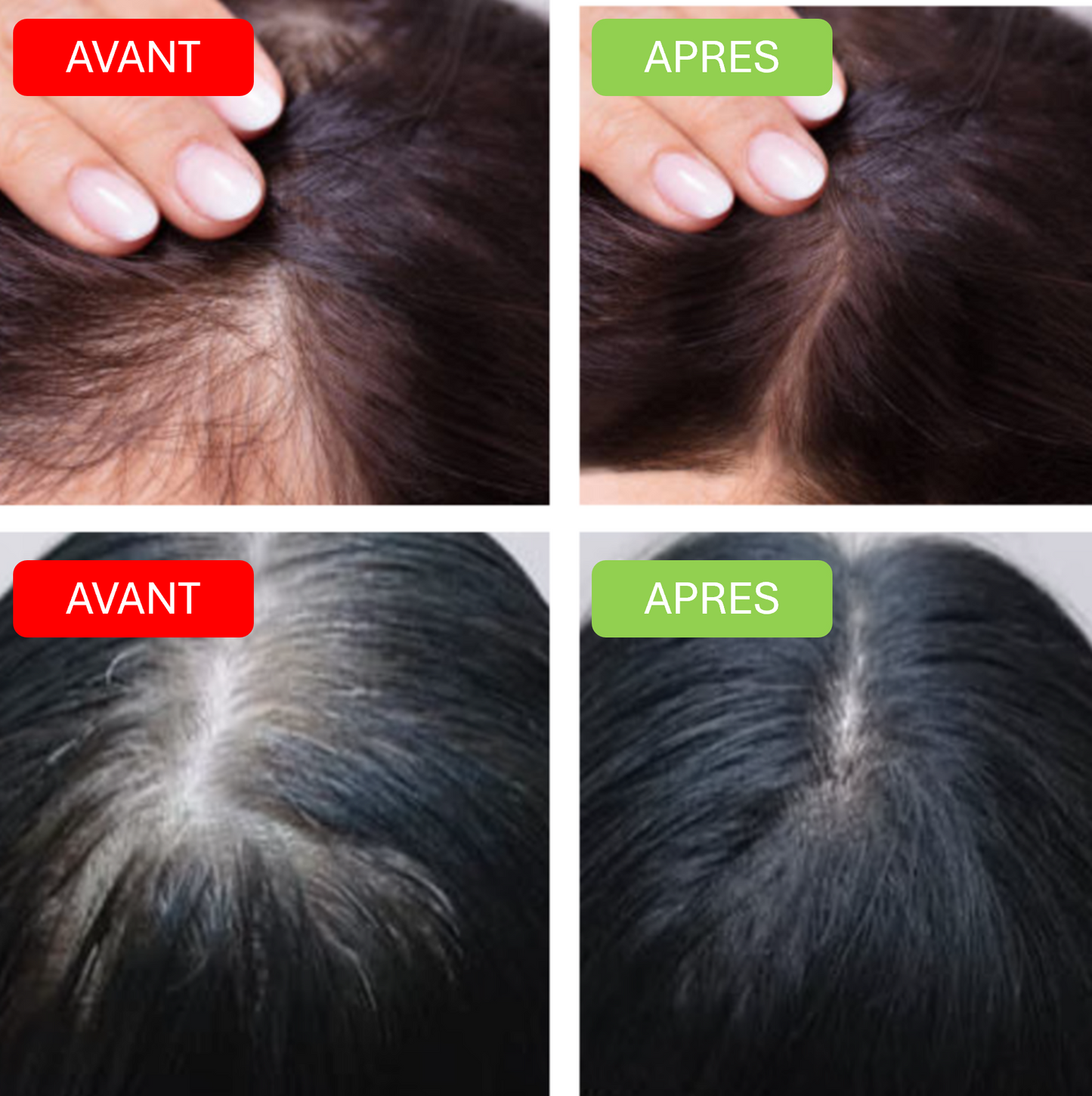 Brosse antichute massante AuraLiss™